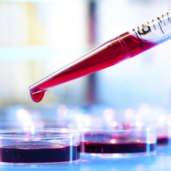A closeup of a pipette carefully placing red droplets into a petri dish.